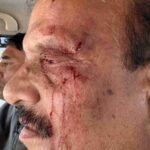 प्रारंभिक शिक्षा निदेशक से मारपीट, बीजेपी विधायक उमेश शर्मा काऊ के समर्थकों पर लगा आरोप,  सियासत गरमाई